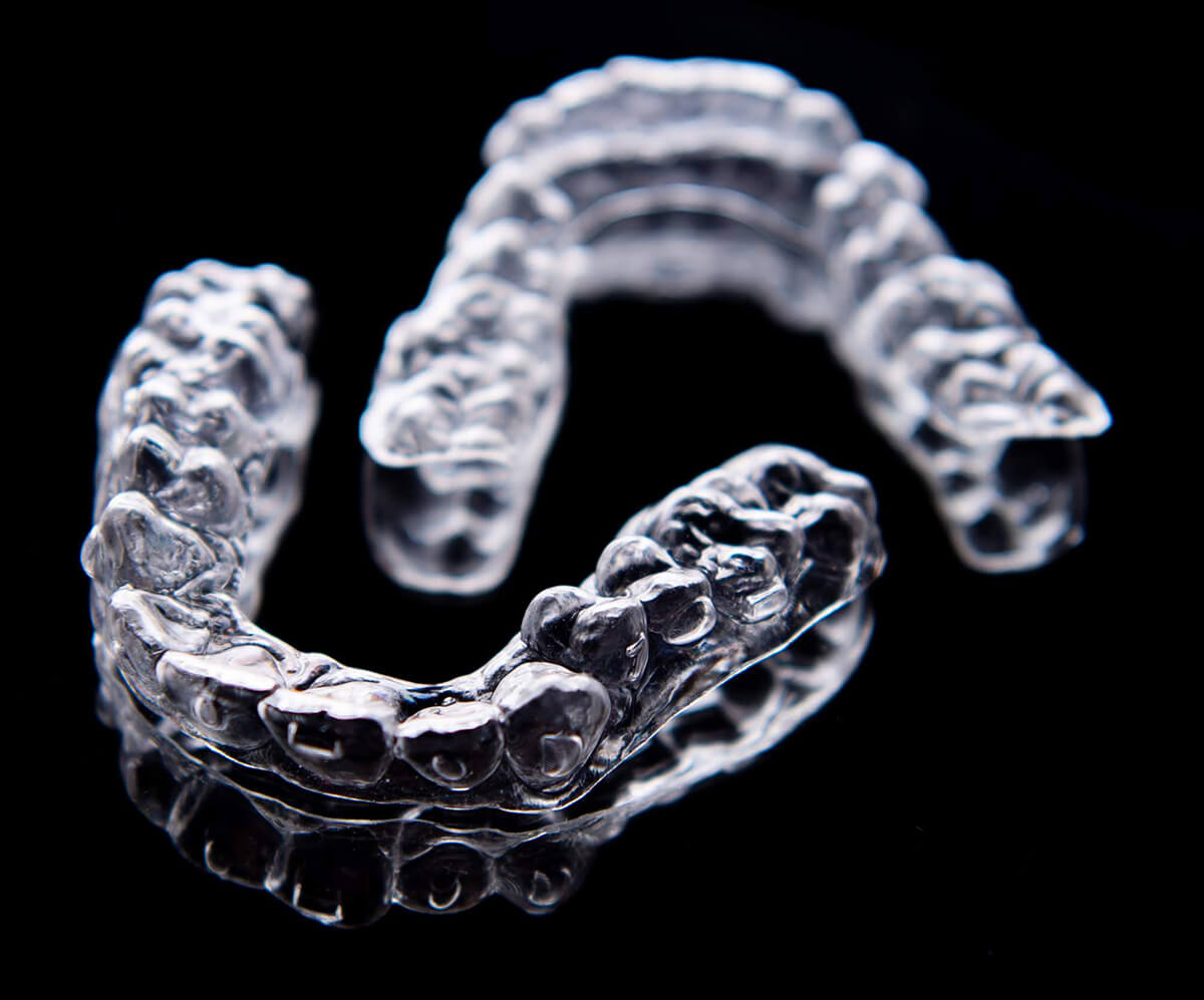 Aligners